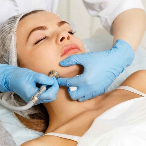 Hydra Facial - Image 2