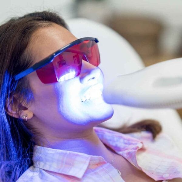 Teeth Whitening Treatment